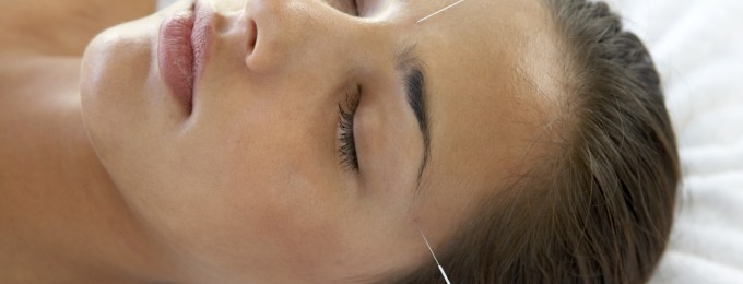 Akupunktur helbreder